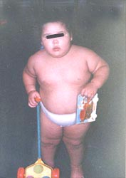 obese_child_s.jpg