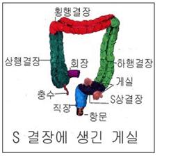 제7권 16장 17-1.jpg