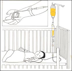 intravenous-hydration-3-9s.jpg