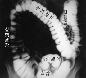 bariumenemalargeintestine.jpg