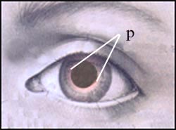 pupils-dilatation-2s (1).jpg