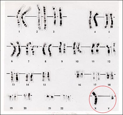 malechromosome.jpg