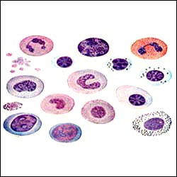 leukocytes-13s.jpg