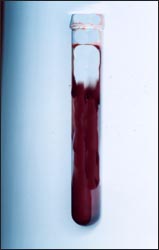 blood-specimen-1s.jpg
