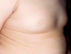 breast enlargement_2_s.jpg