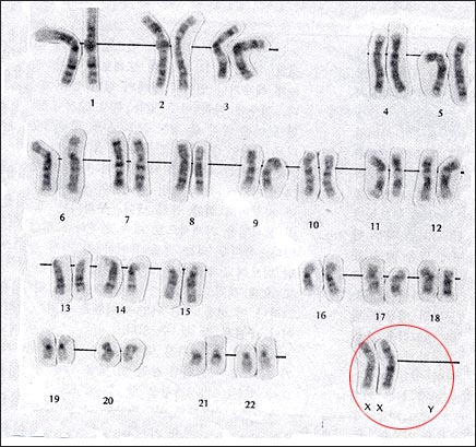 femalechromosome.jpg