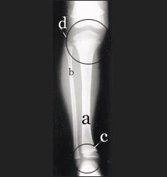 knee_joint_tibia_fibula_ankle_joint_1_4s.jpg