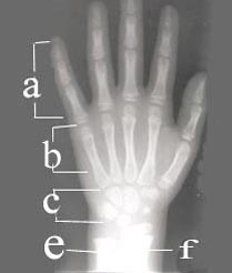 hand-bone-1-1s.jpg