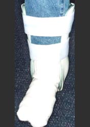 tibia_fracture_splint_3_1s.jpg