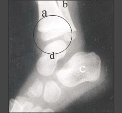 ankle_joint_3_01s.jpg