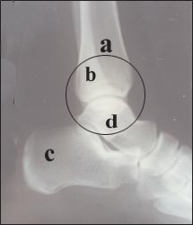 ankle_joint-4s.jpg