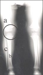 knee_joint_-tbia_fibla_ankle_joints1_s.jpg