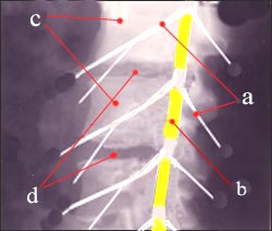 spinal-cord-p-n-1s.jpg