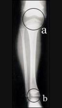 knee_joint_tibia_fibula_ankle_joint_1_1s.jpg