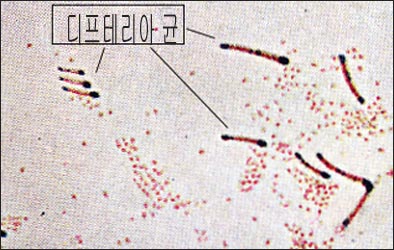 diphtheria-bac-3s.jpg