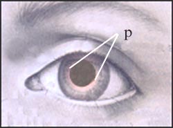 pupils-dilatation-2s.jpg