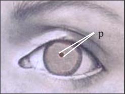 pupil-constricte-1-1s.jpg