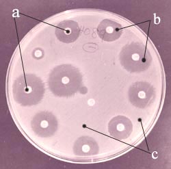 bacterial_culture_and_sensitivity_test2_1s.jpg