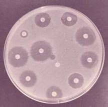 bacterial_culture_and_sensitivity_test-2s.jpg