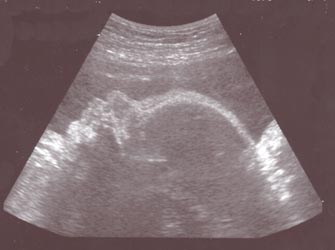 fetus-sleepng-36w-1s.jpg