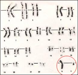 chromosome-male-1-1s.jpg