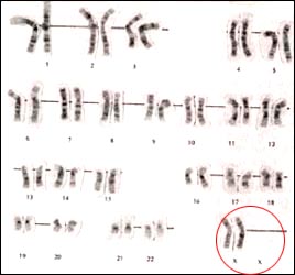 chromosome-female-1-1s.jpg