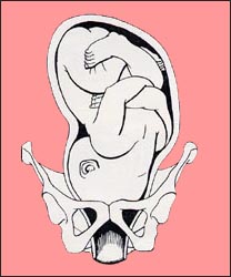 fetal-position-7s.jpg