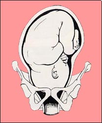 fetal-position-6s.jpg