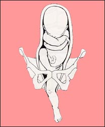 fetal-position-12s.jpg