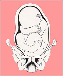 fetal-position-14s.jpg