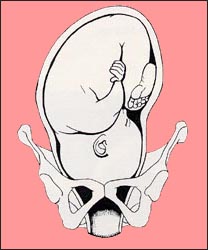 fetal-position-5s.jpg