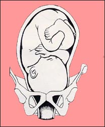 fetal-position-4s.jpg