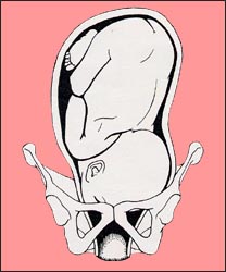 fetal-position-8s.jpg