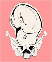 fetal-position-3s.jpg