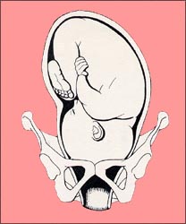 fetal-position-2s.jpg