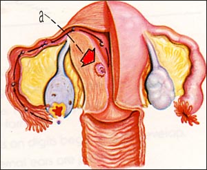 injplantation-endometrium-1s.jpg