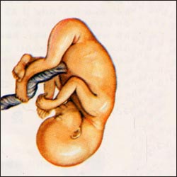 fetus-12wks-1s.jpg