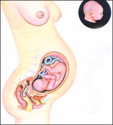 fetal-growth-7m-1s.jpg