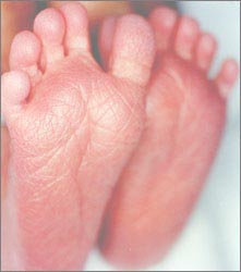 feet-newborn-1s.jpg