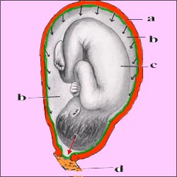 uterine-pressure-1s.jpg