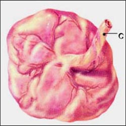 placenta-fetal-surface-1s.jpg