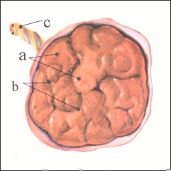 placenta-maternal-surface-1s.jpg